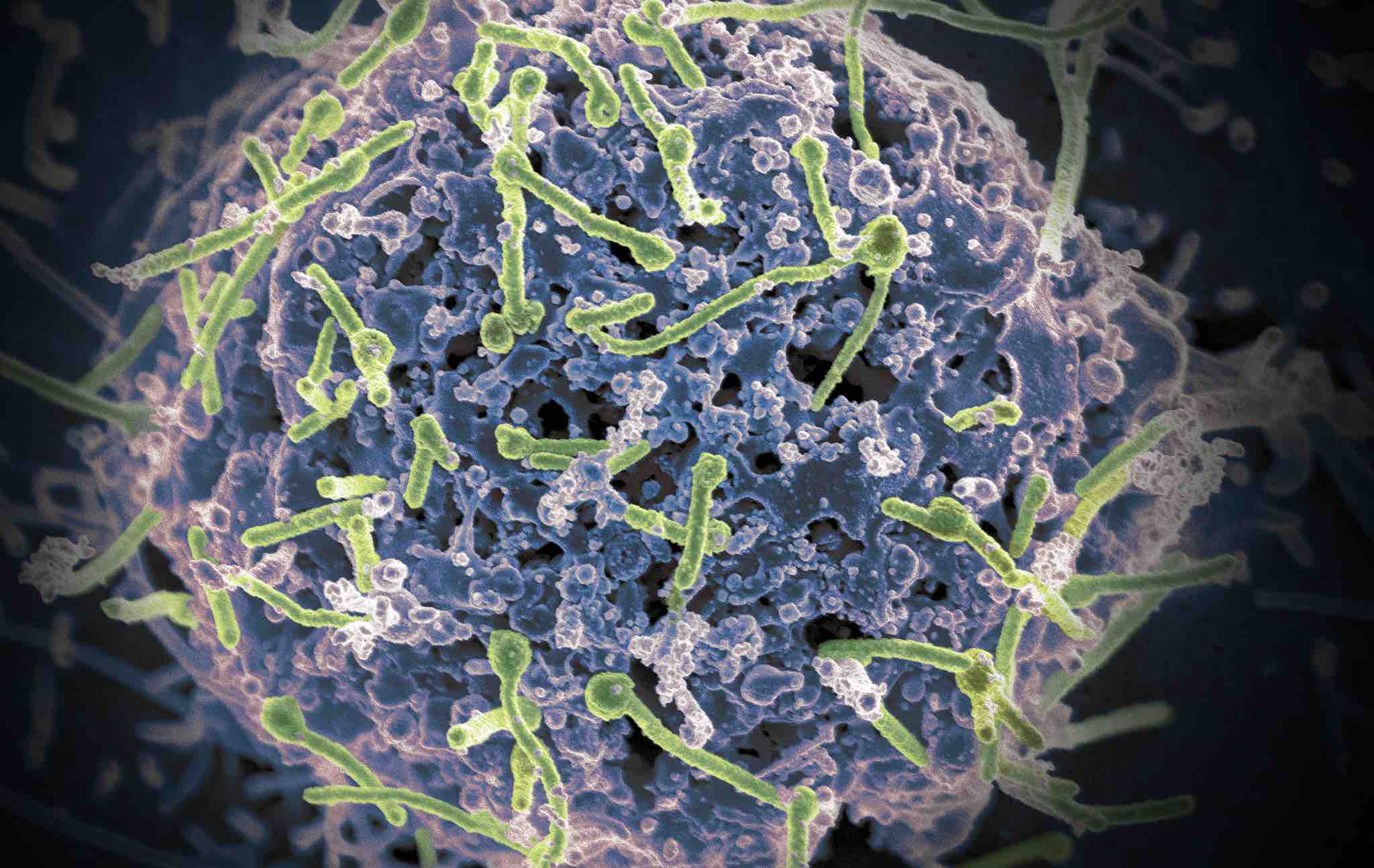 Ebola virus (in green) is shown on cell surface (Photo: NIH Image Gallery/Flickr)