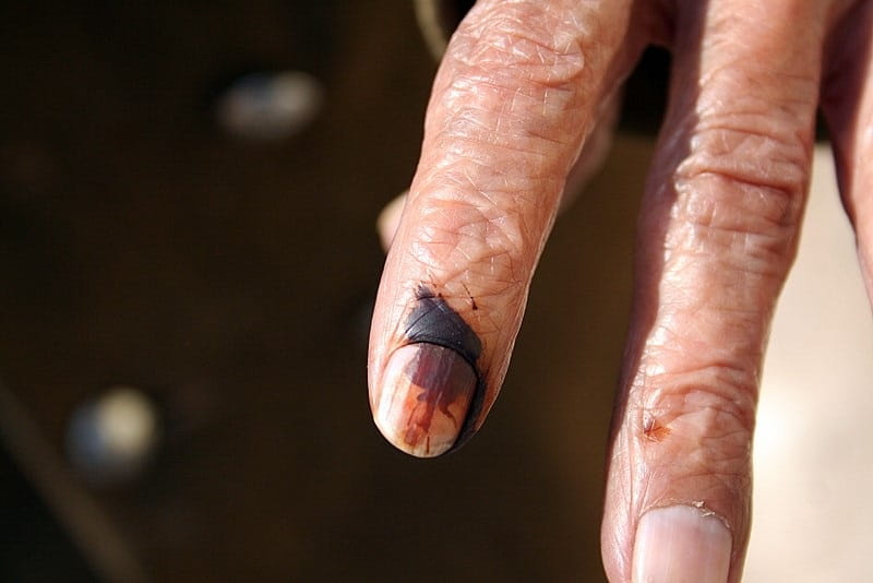 An ink-stained finger after voting
