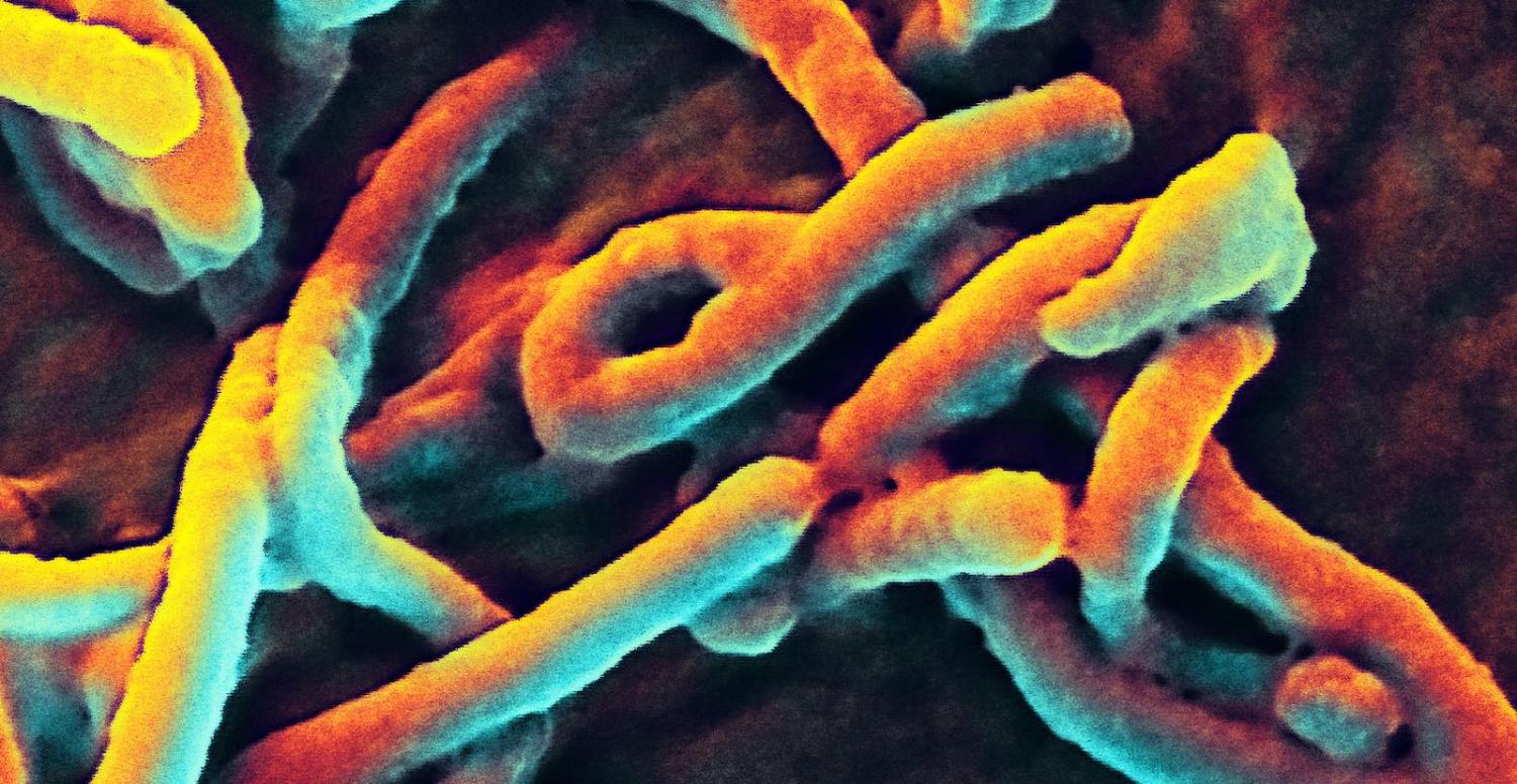 Scanning of an electron micrograph of Ebola virus budding (Photo: NIAID/Flickr)