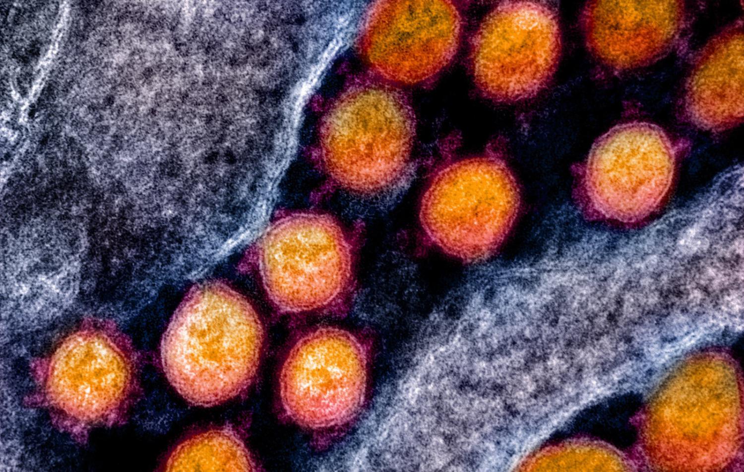 An electron micrograph of virus particles (National Institute of Allergy and Infectious Diseases/Flickr)