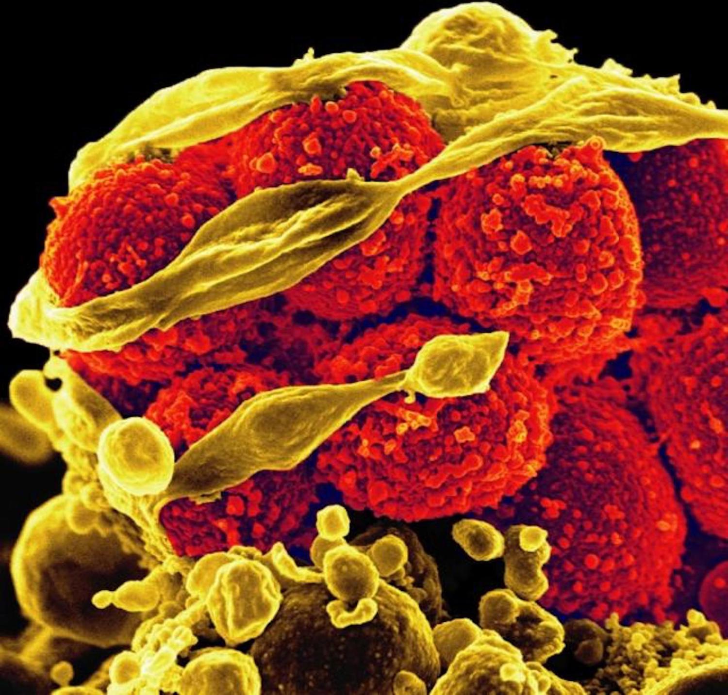 Staphylococcus aureus bacteria killing and escaping from a human white blood cell (Photo: NIAID/Flickr)