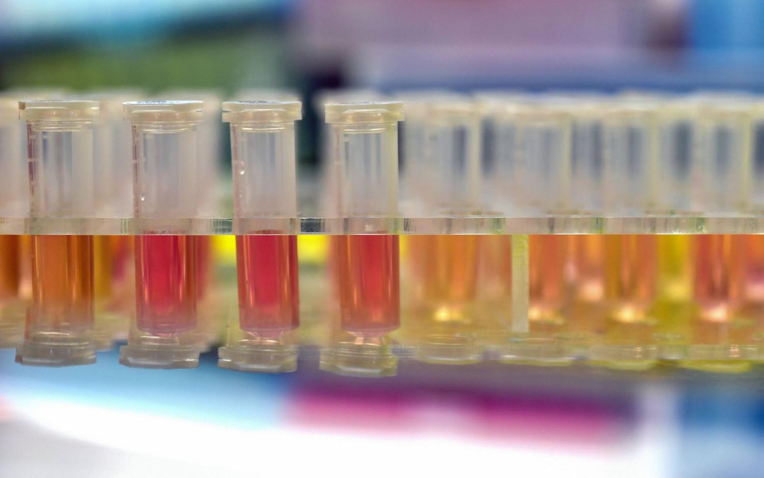 Samples to be tested for coronavirus at the “Fire Eye” laboratory in Wuhan, China, 6 February (AFP via Getty Images)